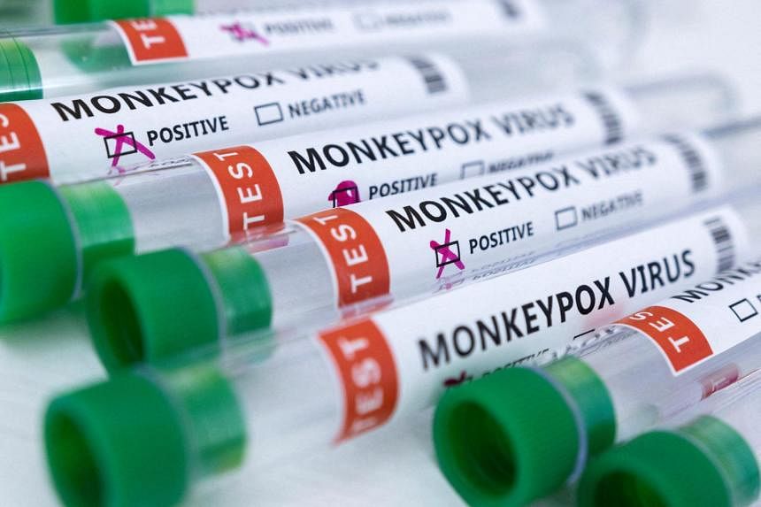 Gejala mirip monkeypox terdeteksi pada gadis berusia 5 tahun di India, sampel dikirim untuk pengujian